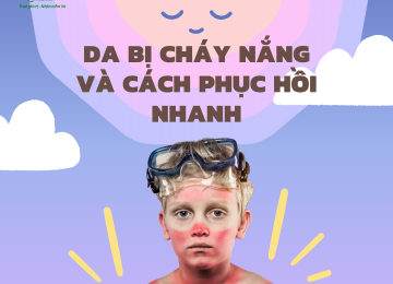 DA BỊ CHÁY NẮNG NÊN LÀM GÌ VÀ CÁCH PHỤC HỒI NHANH LÀN DA BỊ CHÁY NẮNG