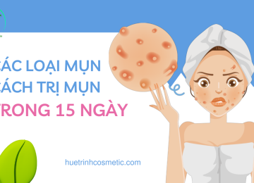 CÁC LOẠI MỤN THƯỜNG GẶP VÀ CÁCH TRỊ MỤN TRONG 15 NGÀY